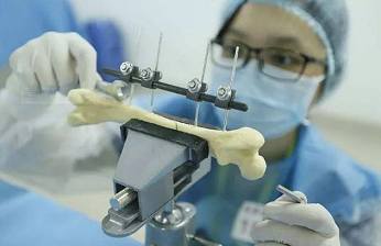 DIC應(yīng)變視覺測量技術(shù)應(yīng)用于知名學(xué)府骨科材料力學(xué)科研