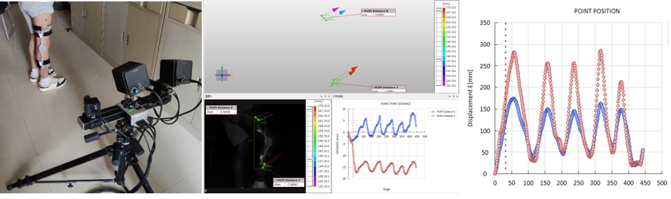 數(shù)字圖像相關(DIC)技術用于腿部支架運動位移測量.jpg 數(shù)字圖像相關(DIC)技術用于腿部支架運動位移測量.jpg